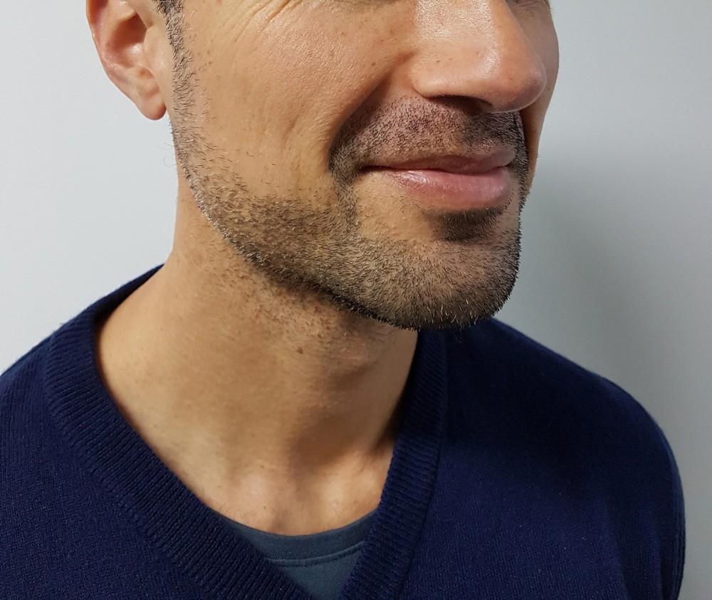 Barbers-Best-Beard-Trimmer