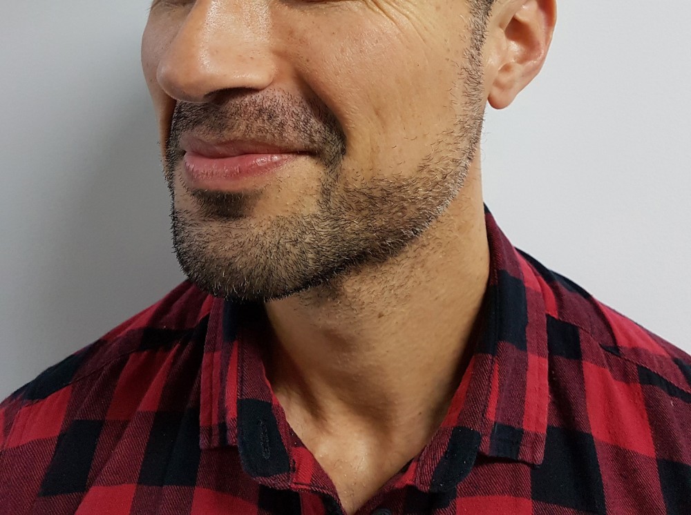 Remington-Barbers-Best-Beard-Trimmer