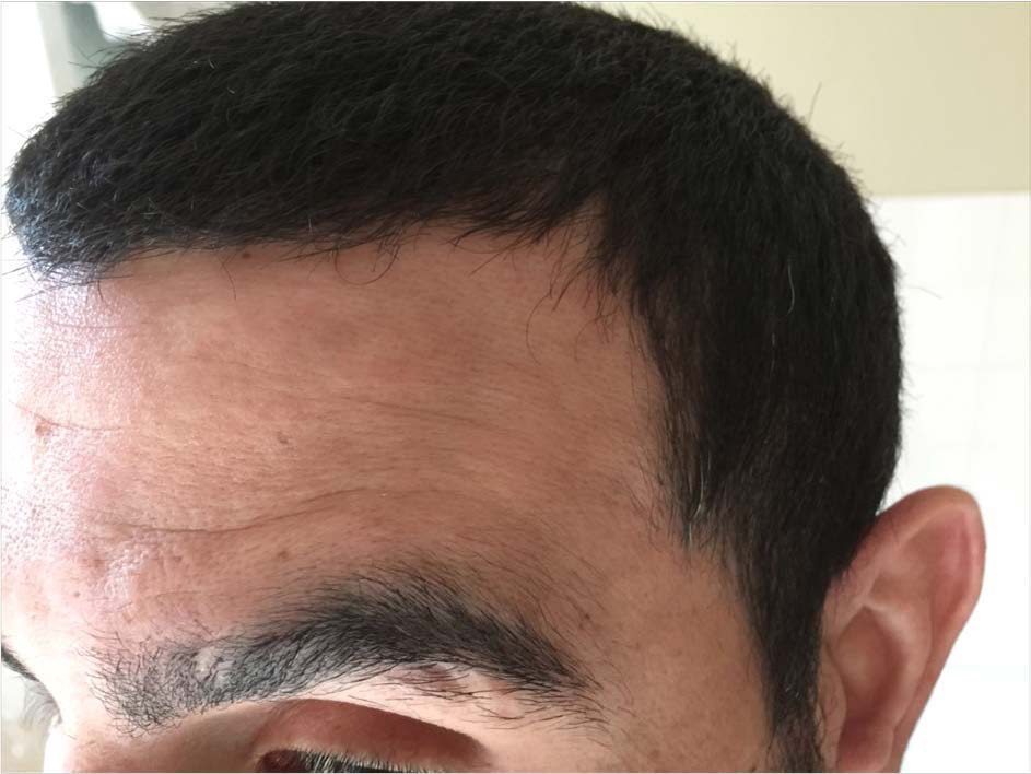 Remington-Barbers-Best-Hair-Clippers